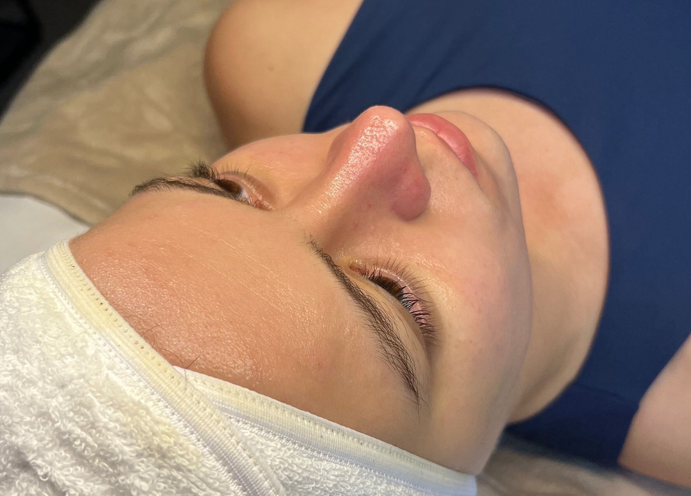 Tratamiento facial en Cosmiatra Ariana Ruilova, ubicada en Samborondón, Guayas, EC. Experiencia rejuvenecedora.