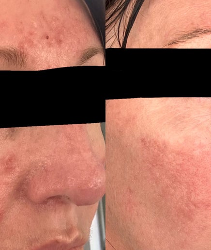Skin with lizzie image 2