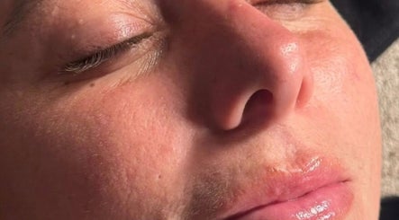Close-up of a serene, relaxed face at James Aesthetics, Northampton, England, GB.