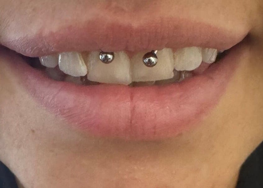 Dental jewelry on teeth at Selina Janes in Ayr, Scotland, GB. Close-up of unique tooth accessories.