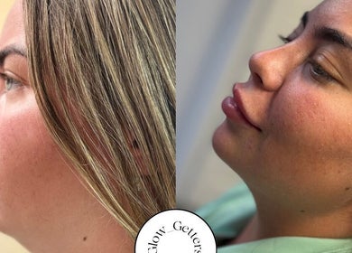 Before-after beauty treatment at Glow Getters, Ballyfermot, County Dublin, IE, showcasing enhanced skin glow.