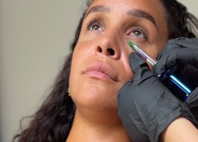 Glow Getters in Ballyfermot, County Dublin, IE offers expert under-eye treatments.