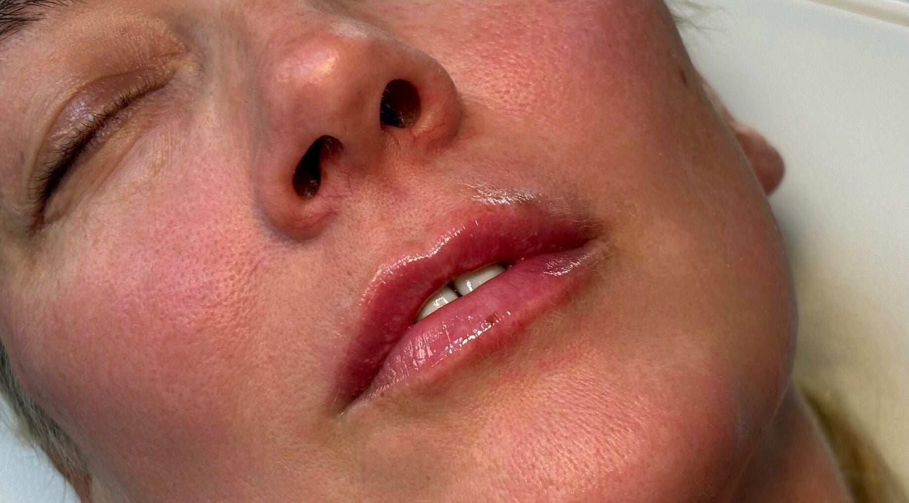 Close-up of smooth, radiant skin after treatment at Glow Getters, Ballyfermot, County Dublin, IE.