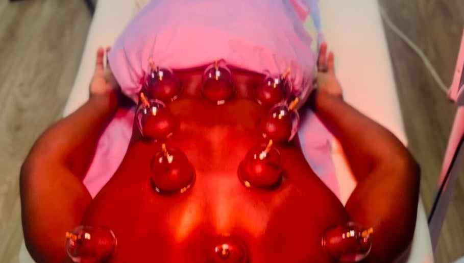 Cupping therapy session at Pain Management Clinic LDN, Ilford, England, GB.