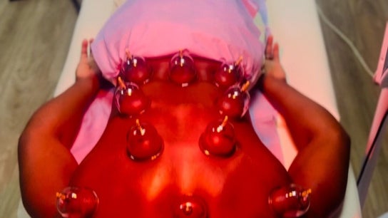 Cupping therapy session at Pain Management Clinic LDN, Ilford, England, GB.