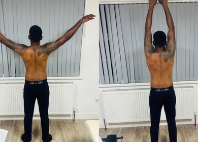 Patient stretching arms at Pain Management Clinic LDN, Ilford, England, GB for wellness therapy.