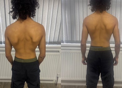 Person displaying back muscles at Pain Management Clinic LDN, Ilford, England, GB for wellness assessment.