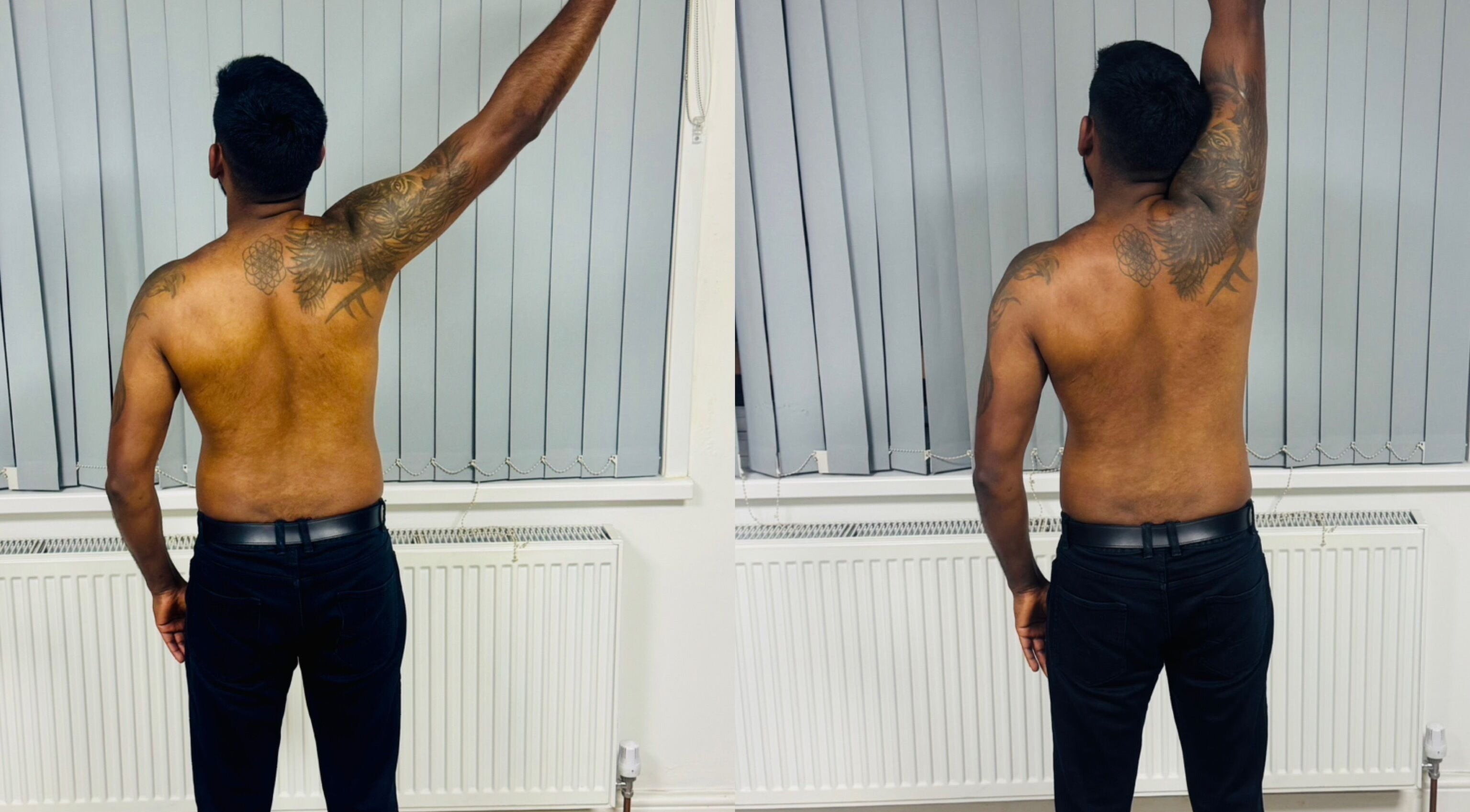 Patient improving arm mobility at Pain Management Clinic LDN, Ilford, England, GB.