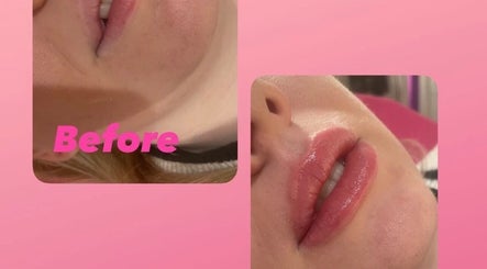 Dreamdolls Aesthetics image 2
