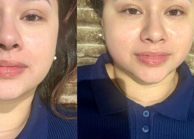 Close-up of a woman's glowing skin after a treatment at The Shape of You, London, England, GB.