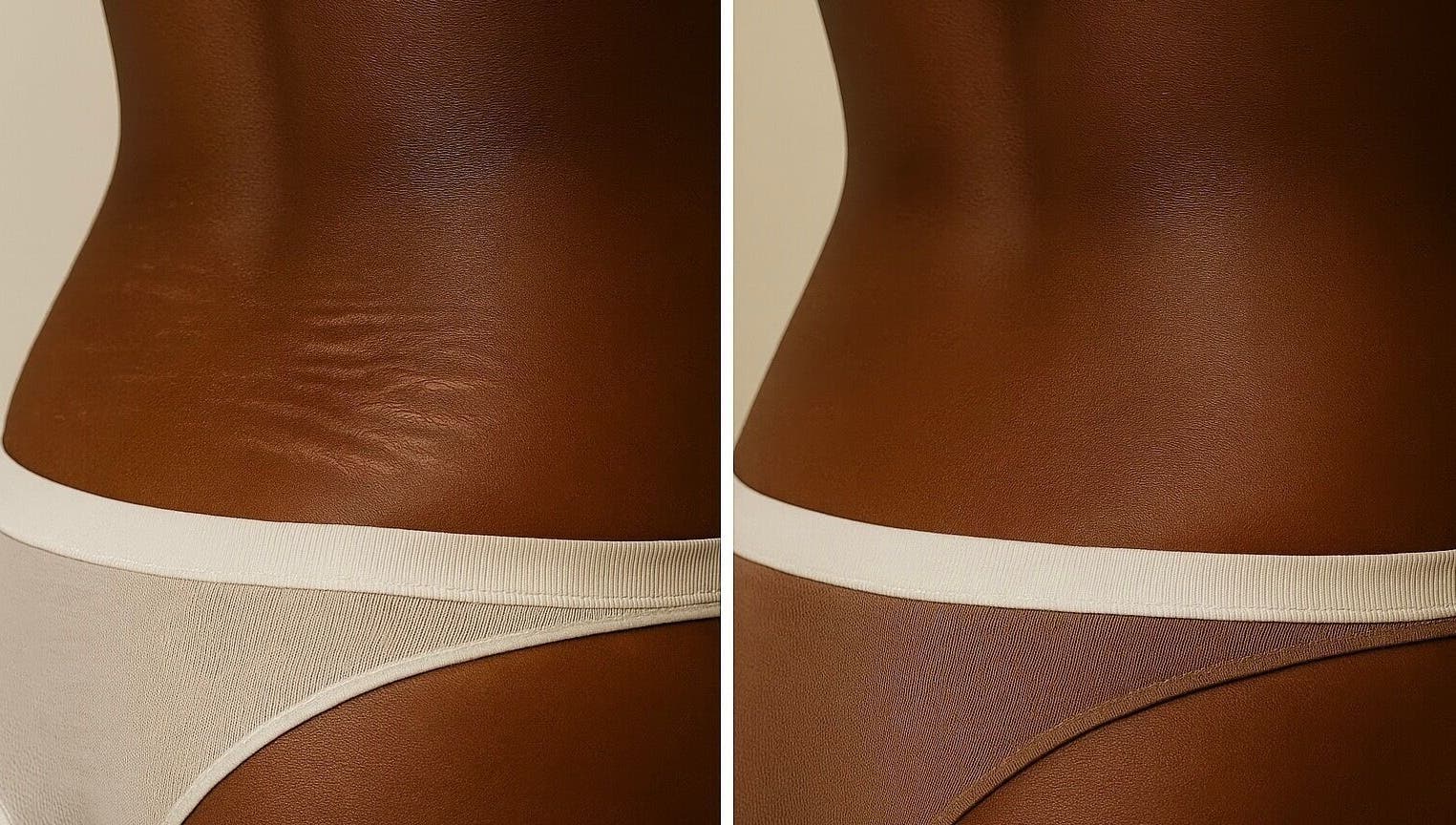 Before and after skin treatment at EnhancedbyMursal, Toronto, Ontario, CA showcasing smoother skin results.