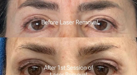 Laser Golden Symmetry image 2