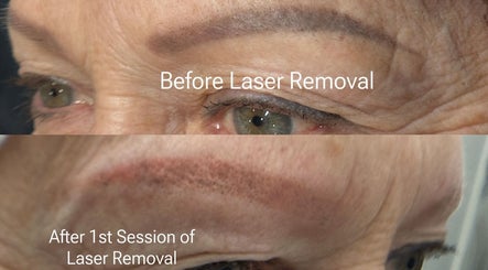 Laser Golden Symmetry image 3