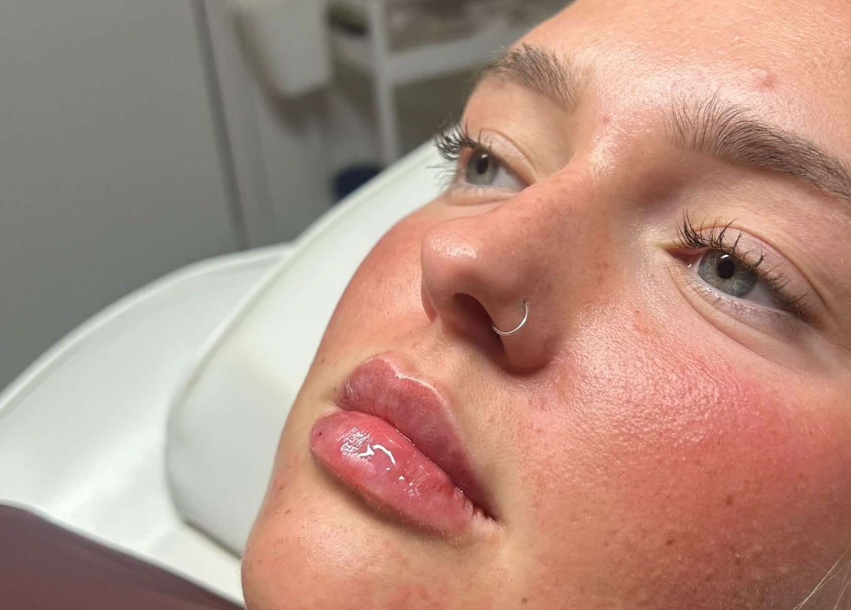 Close-up of rejuvenated skin at Mimis Aesthetics, Shipley, England, GB. Highlighting natural beauty and expert care.