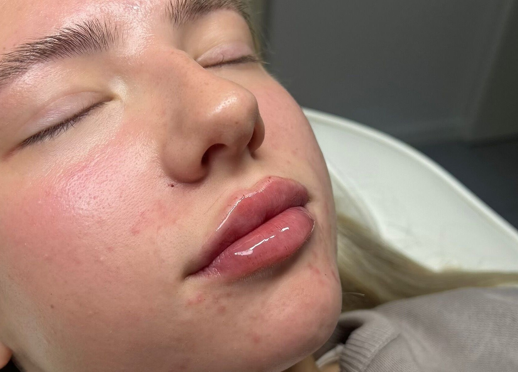 Close-up of a smooth facial treatment at Mimis Aesthetics, Shipley, England, GB.