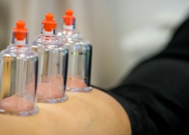 Cupping therapy at Elinos Petrou Physiotherapy Center in Strovolos, Lefkosia, CY for holistic wellness.