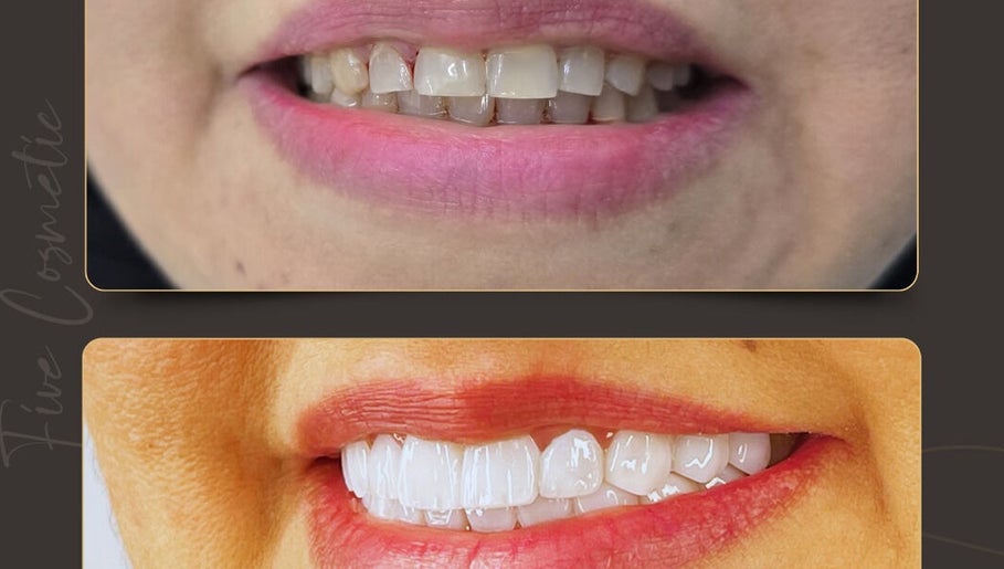 فايف كوزماتيك , لخدمات طب الأسنان والعناية بالوجه في الإمارات image 1