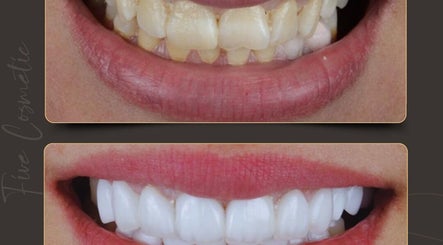 فايف كوزماتيك , لخدمات طب الأسنان والعناية بالوجه في الإمارات image 2