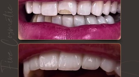 فايف كوزماتيك , لخدمات طب الأسنان والعناية بالوجه في الإمارات image 3