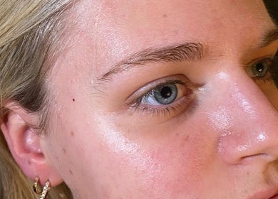 Close-up of glowing skin treatment at Get The Glo Wellness & Beauty, Dorridge, England, GB.
