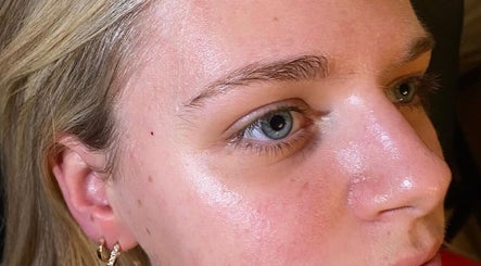 Close-up of glowing skin treatment at Get The Glo Wellness & Beauty, Dorridge, England, GB.