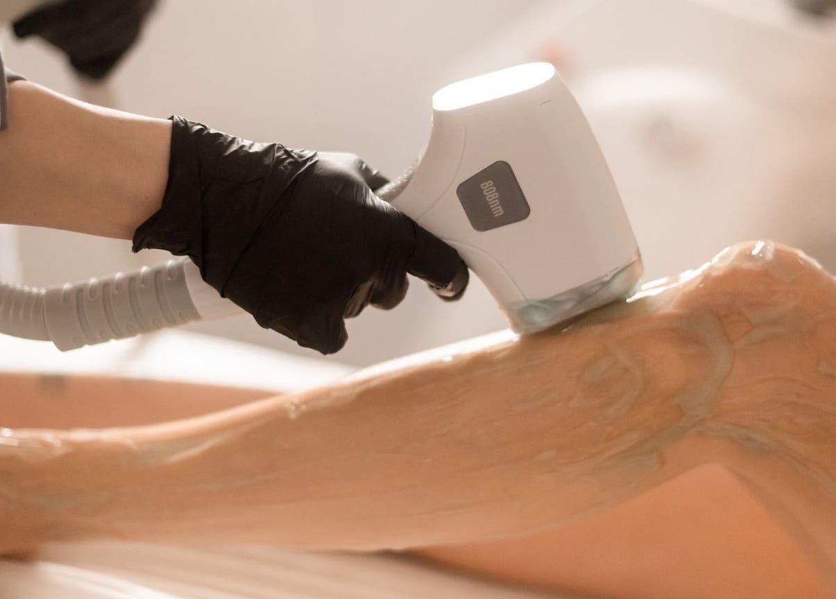 Leg undergoing laser treatment at Lāzer Klīnika Domina, Rīga, LV, showcasing precision care.