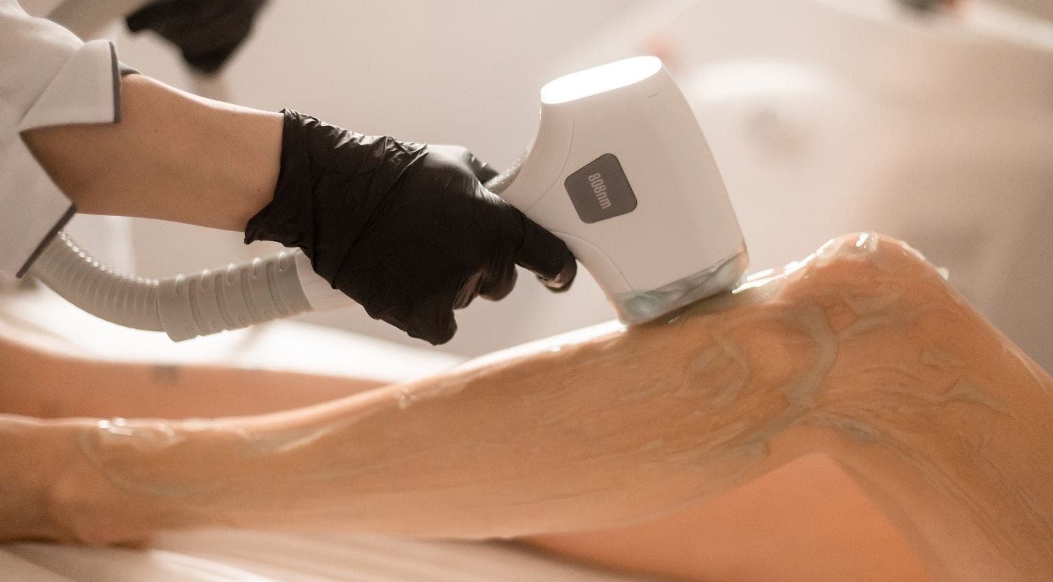 Leg undergoing laser treatment at Lāzer Klīnika Domina, Rīga, LV, showcasing precision care.
