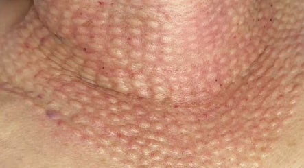 S&N Aesthetics Clinic image 2
