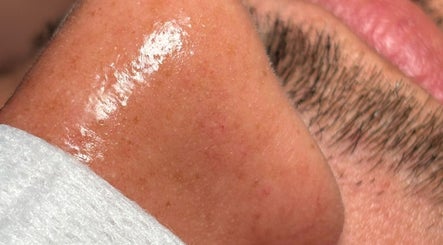 Reyna Tolentino Skin Specialist image 2