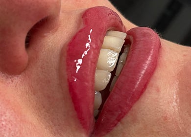 Close-up of glossy crimson lips after treatment at Face Couture, London, England, GB.