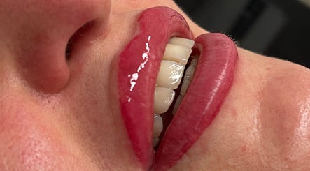 Close-up of glossy crimson lips after treatment at Face Couture, London, England, GB.