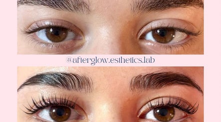Gambar Afterglow Esthetics Lab 3