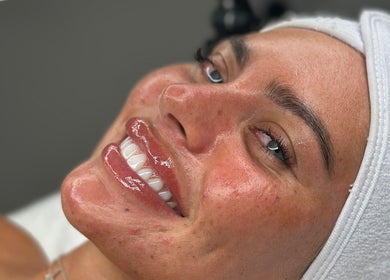 Smiling woman with glowing skin post-treatment at Derma Touch Skin Clinic, Widnes, England, GB.