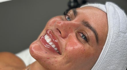 Smiling woman with glowing skin post-treatment at Derma Touch Skin Clinic, Widnes, England, GB.