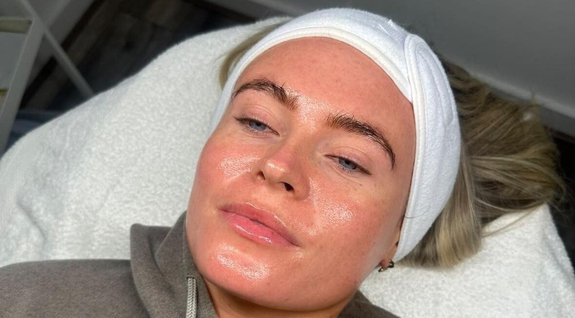 Client enjoying a rejuvenating facial at Derma Touch Skin Clinic, Widnes, England, GB. Her skin glows post-treatment.