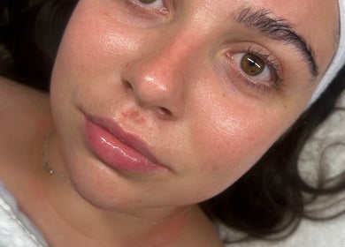 Close-up of a woman's glowing skin after treatment at Derma Touch Skin Clinic in Widnes, England, GB.
