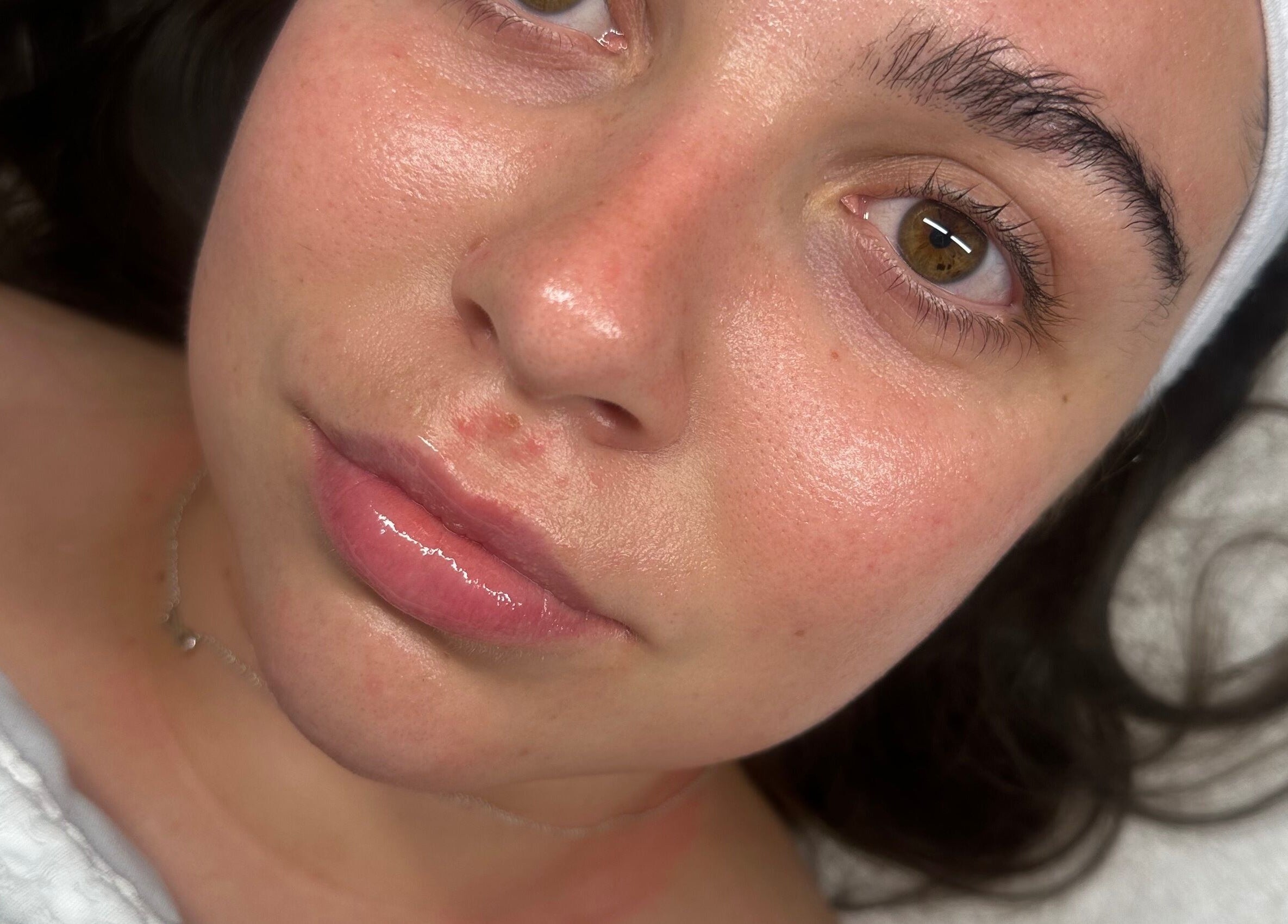 Close-up of a woman's glowing skin after treatment at Derma Touch Skin Clinic in Widnes, England, GB.