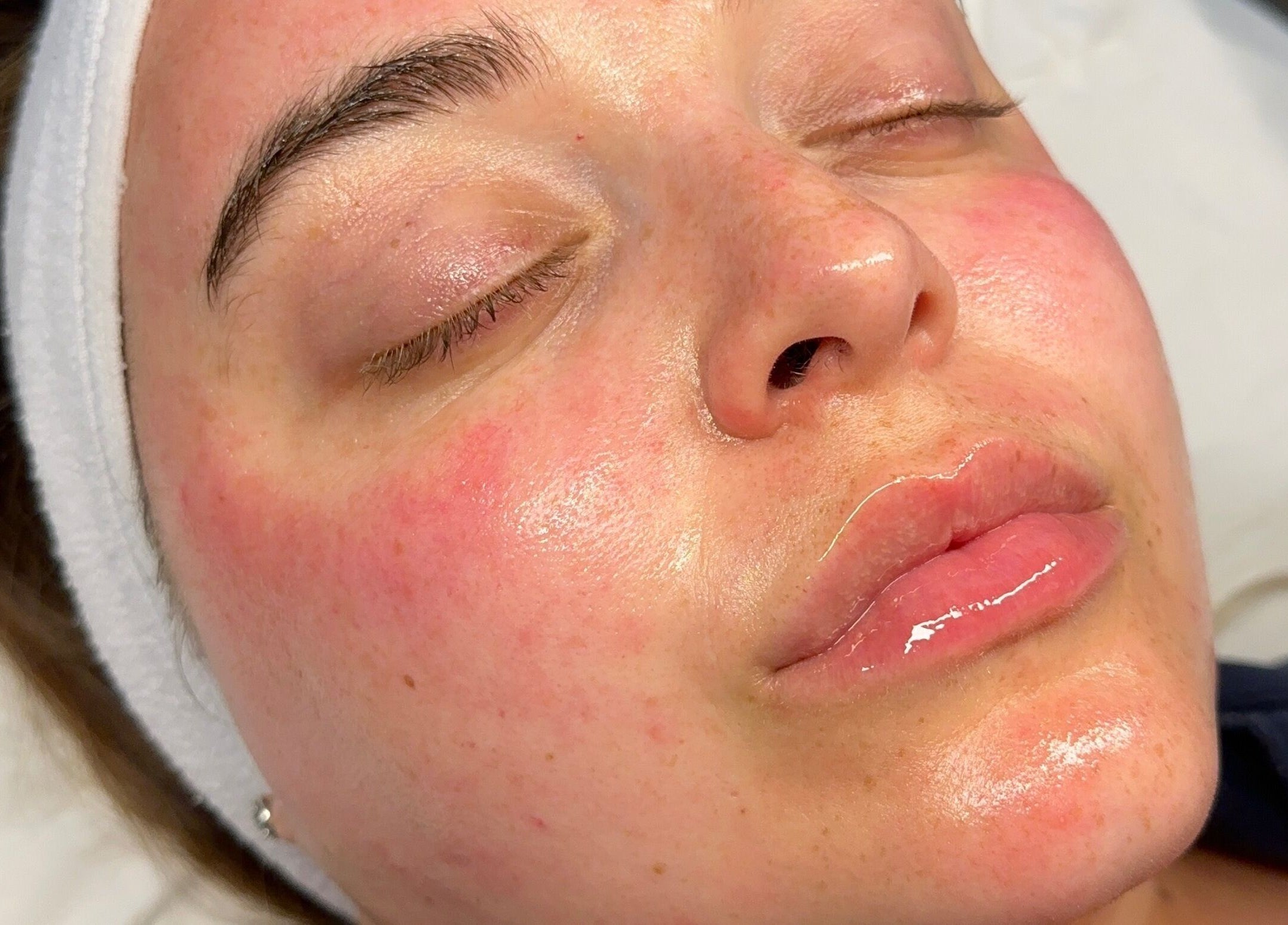 Close-up of a client with radiant skin after treatment at Derma Touch Skin Clinic, Widnes, England, GB.