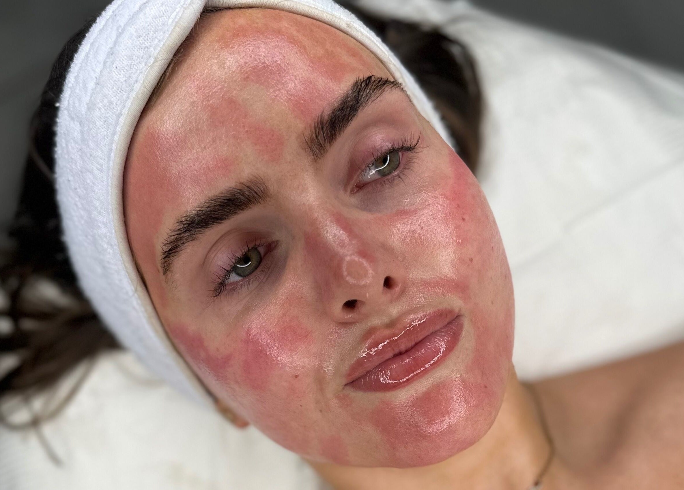 Client after skincare treatment at Derma Touch Skin Clinic, Widnes, England, GB, showcasing a radiant glow.