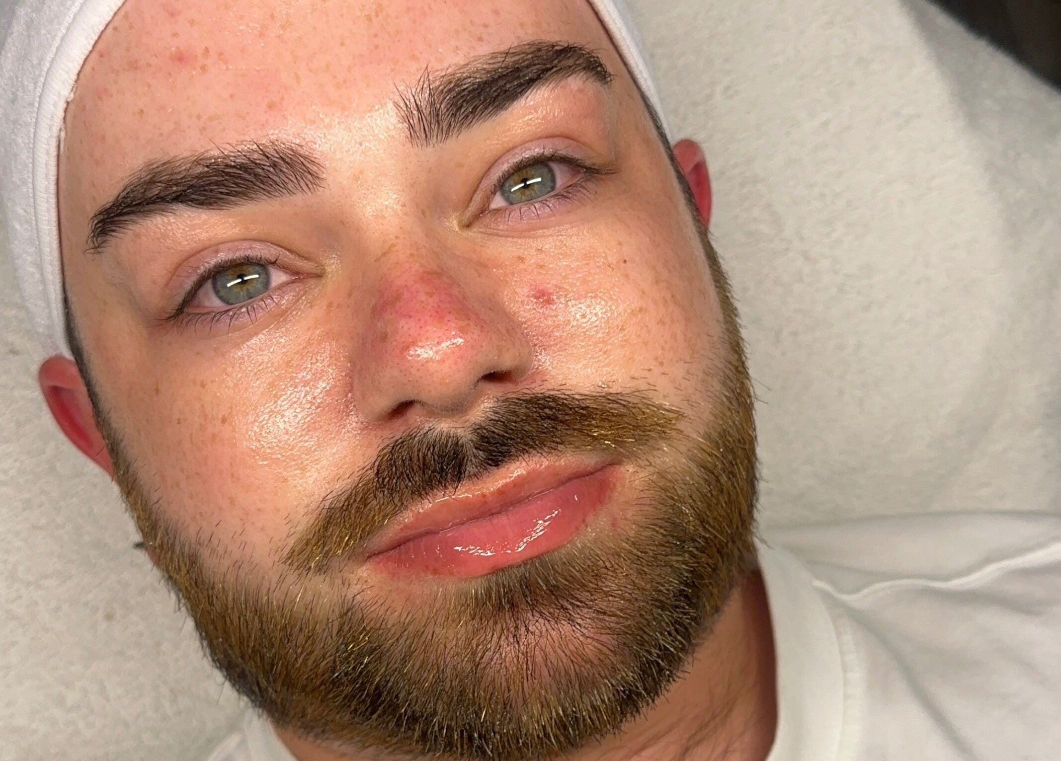 Relaxed man post-treatment at Derma Touch Skin Clinic, Widnes, England, GB. Glowing skin and refreshed appearance.