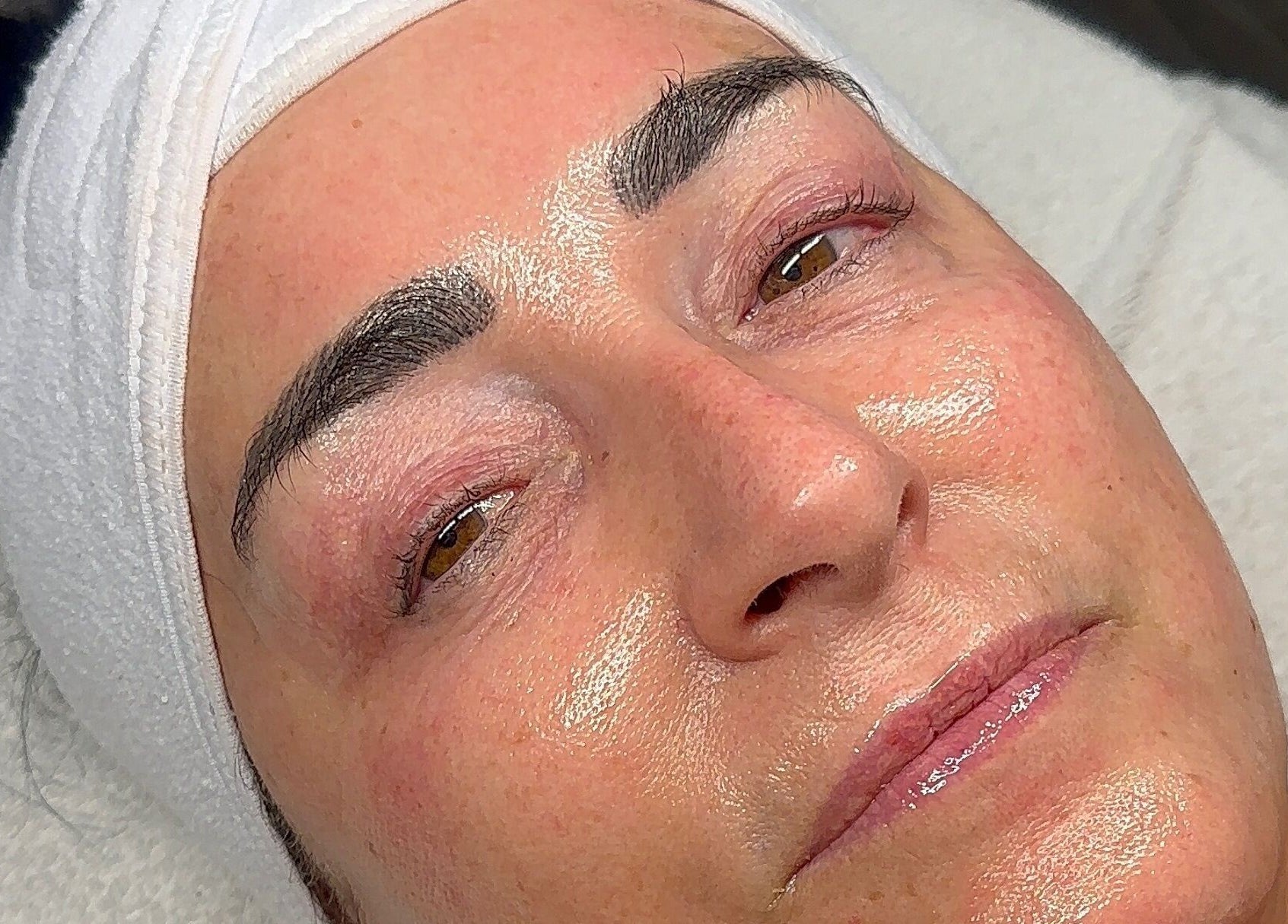 Glowing skin after facial at Derma Touch Skin Clinic, Widnes, England, GB.