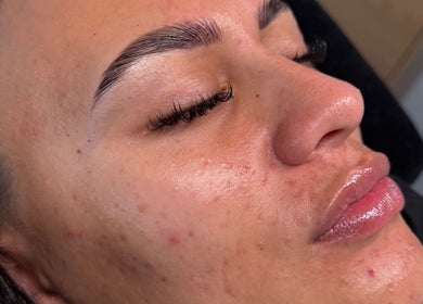 Close-up of a woman's glowing skin after treatment at Linèa Beauty, Acacia Ridge, Queensland, AU.