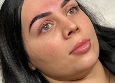 Close-up of radiant skin after treatment at Arched Oasis, Melbourne, Victoria, AU.