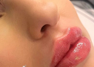 Close-up of glossy lips treatment at Studio H Aesthetics, Barbers & Hair, Norwich, England, GB.