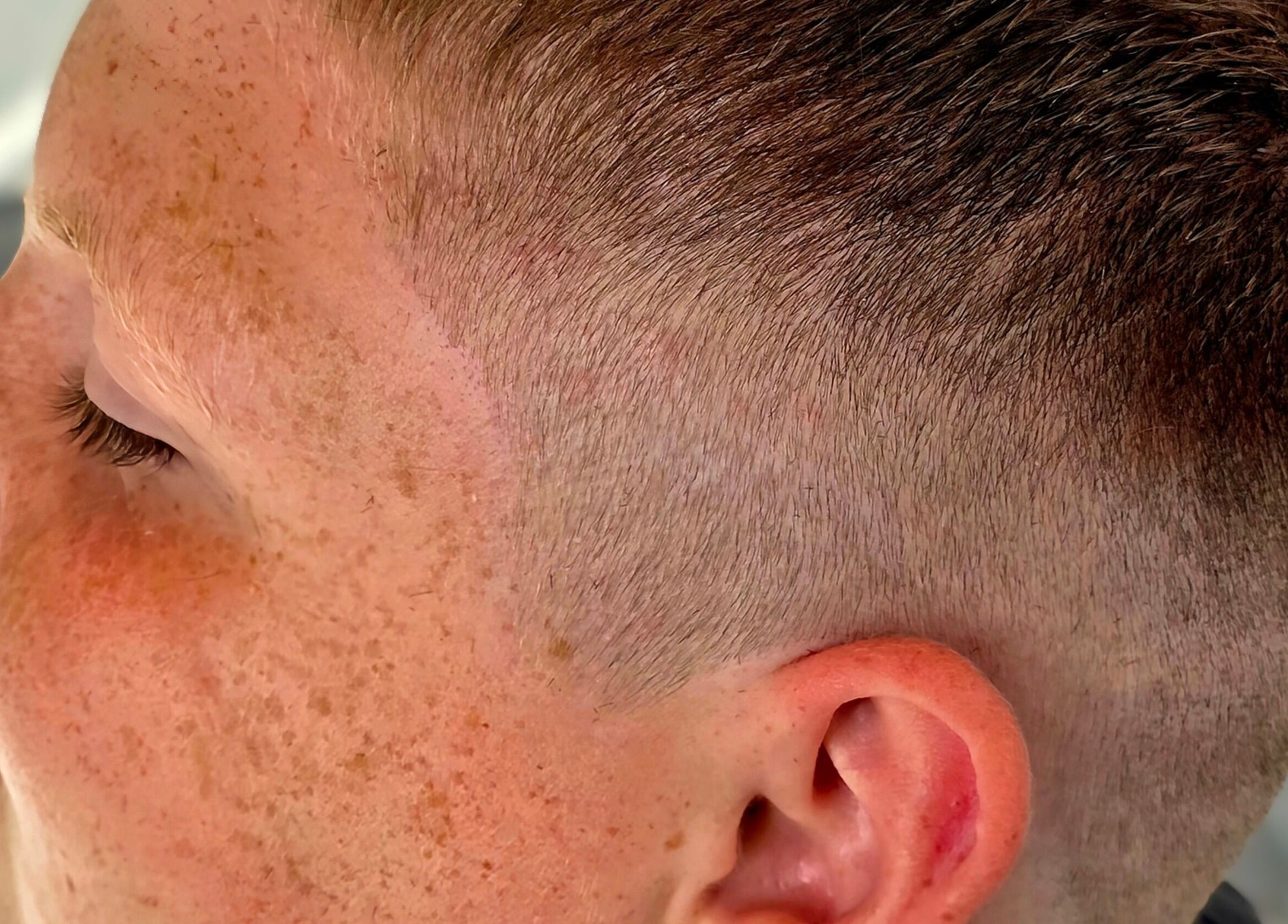Close-up of a precision fade haircut at Fandvstudio in Macclesfield, England, GB, highlighting freckles.