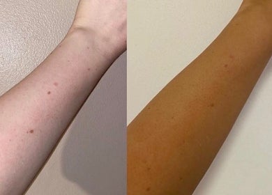 Before and after tanning results at Sunlux Tanning & Beauty, Preston, England, GB. Visible skin tone change.