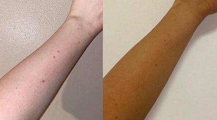 Before and after tanning results at Sunlux Tanning & Beauty, Preston, England, GB. Visible skin tone change.