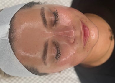 Close-up of a relaxed face glowing after treatment at HYDRASKIN STUDIO, London, England, GB.