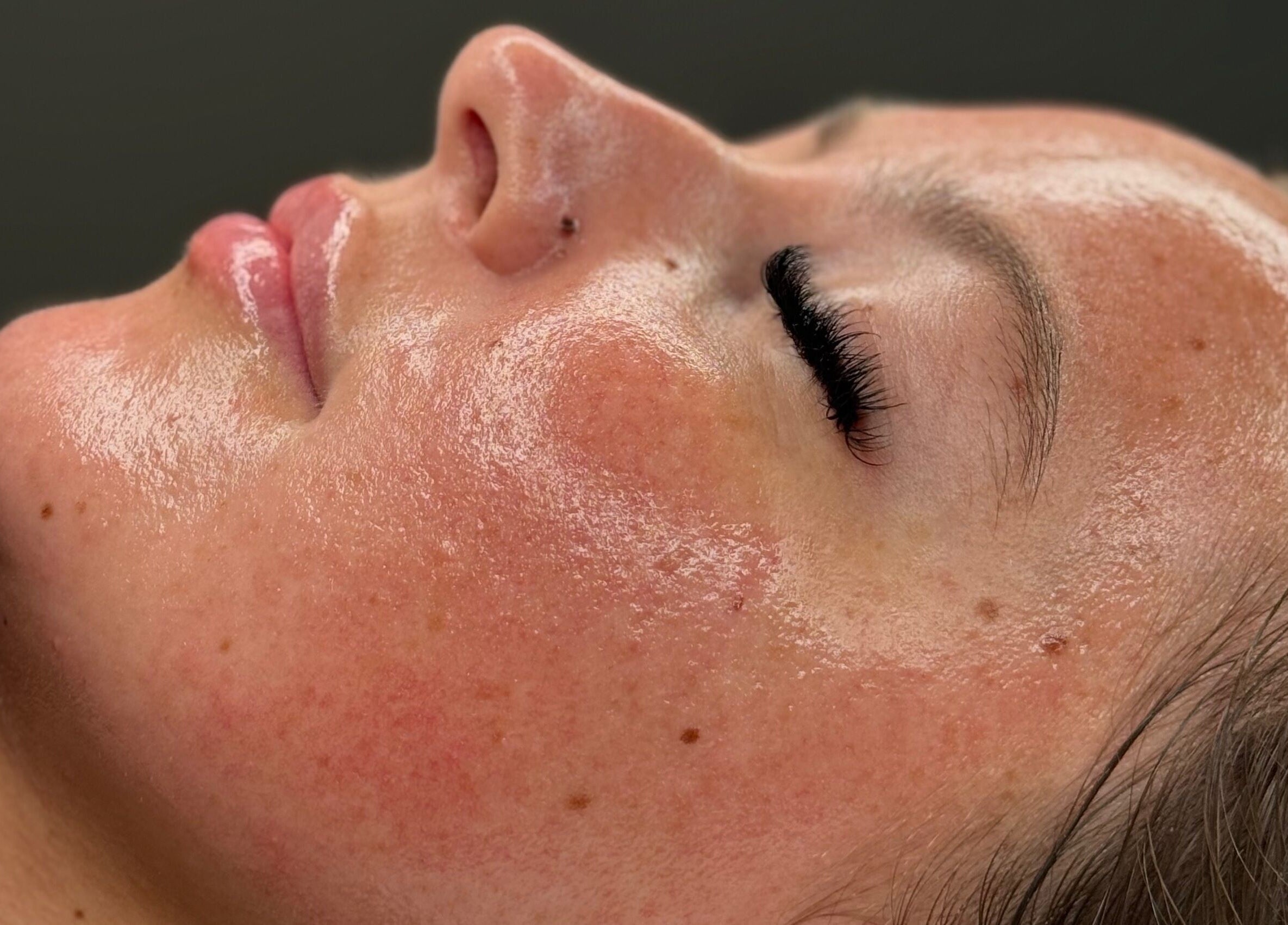 Revitalized skin with a radiant glow after treatment at HYDRASKIN STUDIO, London, England, GB.