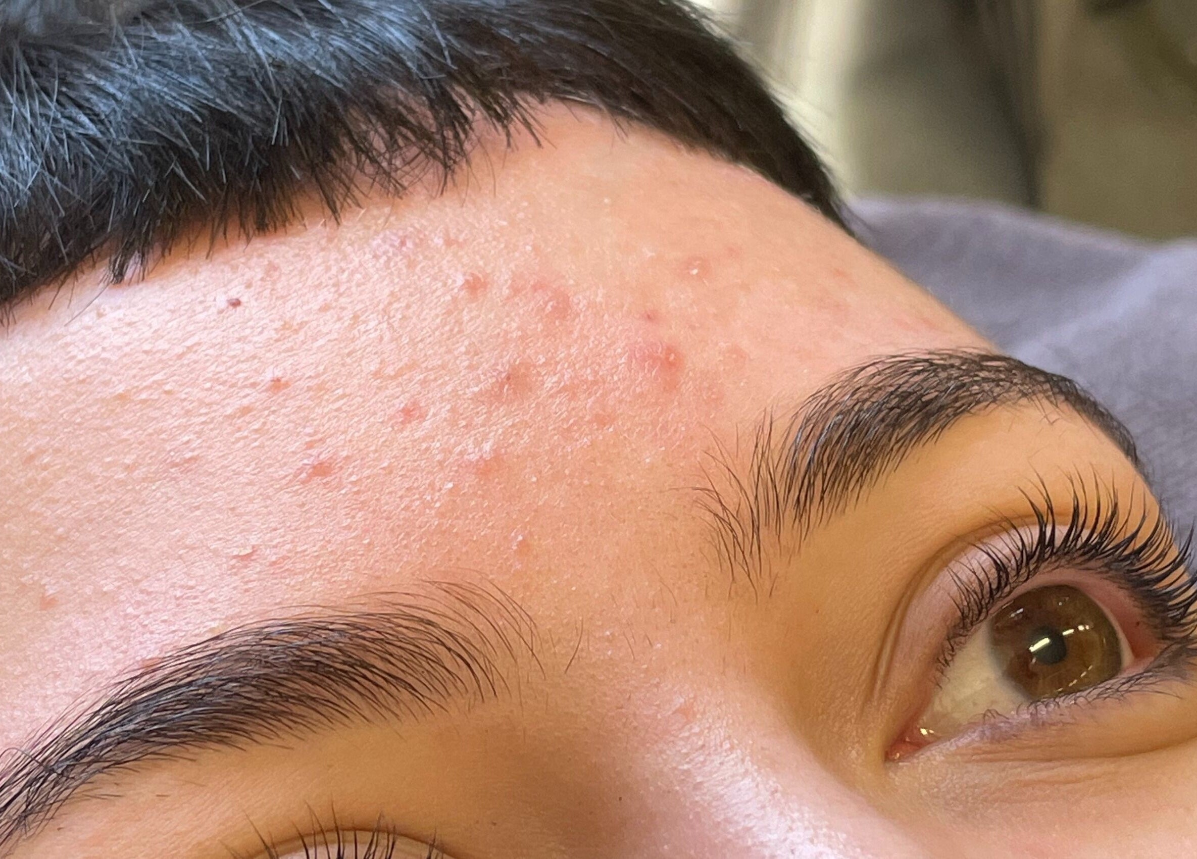 Close-up of skin analysis at Possession Beauty, Thirroul, New South Wales, AU. Highlighting natural skin details.